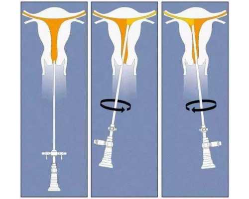 les怎么怀孕,贵州同性？贵州热门试管婴儿助孕医院推荐？