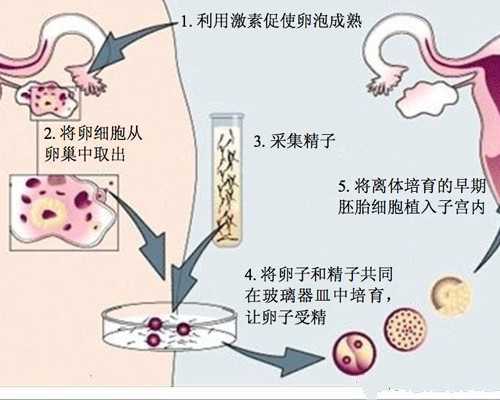 两个女孩子做试管婴儿的依据,同性私立的助孕公司做一次试管成功率大概多少
