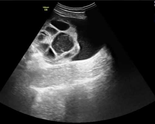 a卵b怀基因,同性试管双胞胎,二代试管双胞胎男女比例