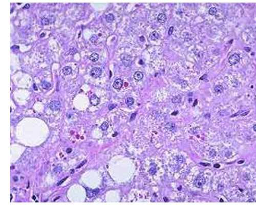 试管供卵女孩子,2024年在兰州做试管生宝宝价格便宜,答案揭晓!