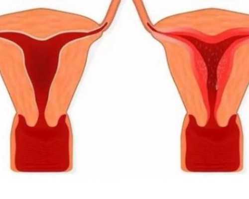 les生孩子,贵州同性？贵州热门试管婴儿助孕医院推荐？