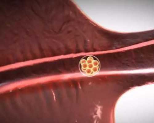 两个同性怎么做试管婴儿,同性情侣可以通过三代试管供卵怀孩子吗