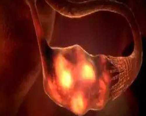 世纪助孕集团代妈_上海世纪助孕可靠吗,重庆借卵试管代生 重庆大坪医院生殖医