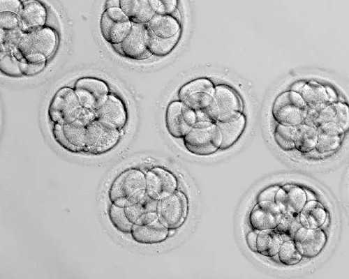 两个女人的卵子可以试管生孩子吗,美国有没有同性试管做，同性恋去美国能做