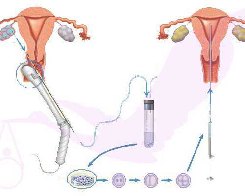 拉拉a卵b怀费用,拉萨同性试管2代多少钱_三代试管助孕机构