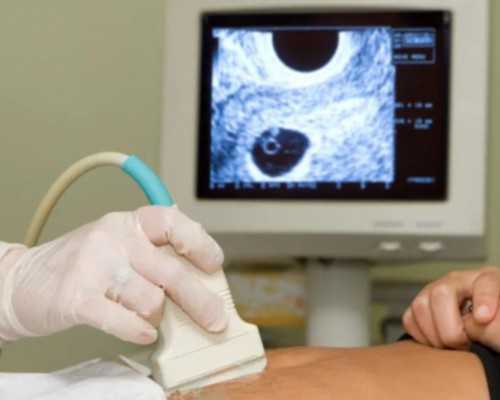 百合试管只有女性,同性中南医院做人工授精一次成功的话要花大概多少钱？