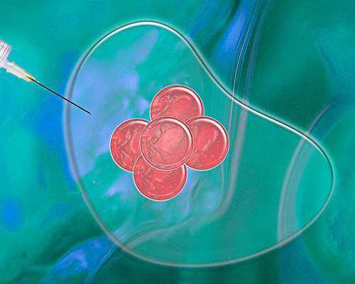 百合可以生孩子了,同性试管婴儿多少钱，中介收费92994元