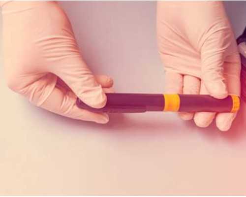 同性湘雅附一生殖中心做试管婴儿取卵会打麻药吗？