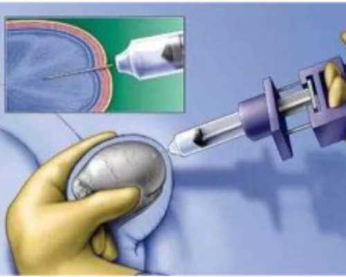 拉拉生孩子要多少钱,2024
同性情侣可以通过试管助孕供精怀宝宝吗