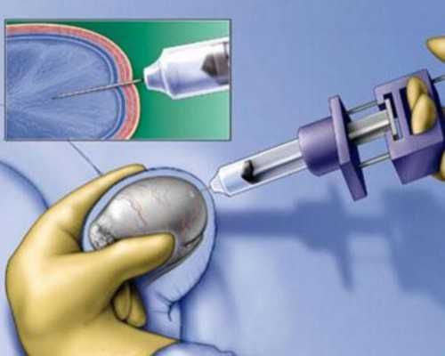 同性试管助孕机构,找****产子公司,试管婴儿包成功包生男孩
