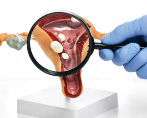 同性男男代怀,云南三代试管需花多少钱？