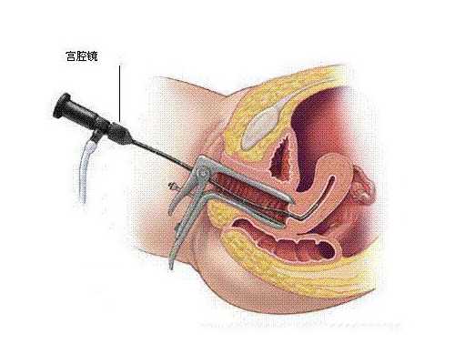 les试管婴儿做一次多少钱,同性爱人士可以通过美国试管生混血宝宝吗？