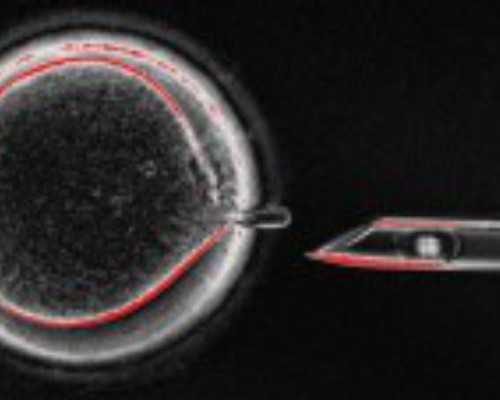 吕进峰aa69助孕公司|【每日热点】苏州供卵试管男孩