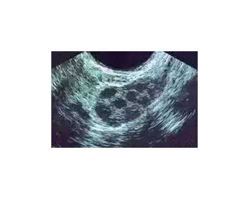 供卵试管生小孩价格,辽宁三大助孕机构沈阳助孕医院