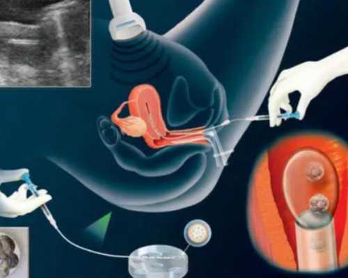 南昌60万助孕包成功包男孩|2024河北供卵试管医院排名top10强推!试管生男孩费用