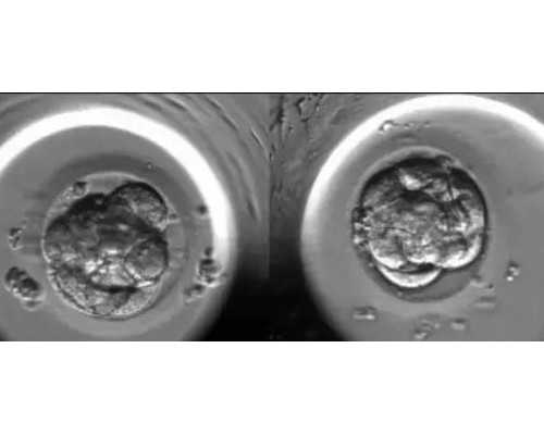 西安助孕选性别包成功|东莞供卵为什么成功率高,供卵试管婴儿成功率