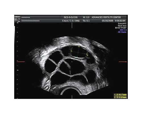广州世纪助孕机构靠谱吗_上海世纪助孕,重庆代生男孩网 2024重庆做试管婴儿可