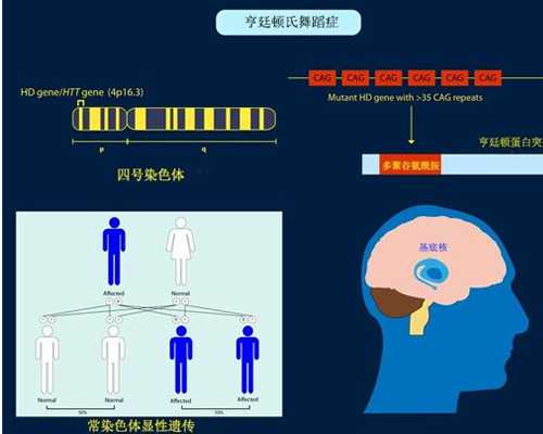 世纪助孕高端机构_上海世纪助孕骗局,重庆代生费用是多少 2024重庆私立助孕机