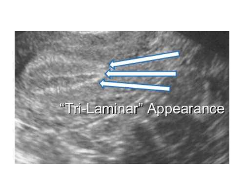 上海世纪助孕集团官网优贝贝好_上海世纪助孕陆仁嘉,重庆代生产子无风险 重庆