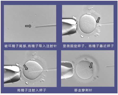 上海试管婴儿去 坤和助孕,温州最大的助孕公司坤和网址多少,安夏健康：为何成